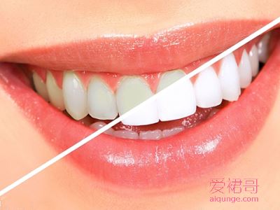 洗牙对牙齿有伤害吗？洗牙后会容易牙敏感